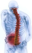 back pain